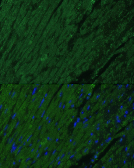 Immunofluorescence analysis of Mouse heart cells using TNNI3 Polyclonal Antibody at dilution of  1:100. Blue: DAPI for nuclear staining.