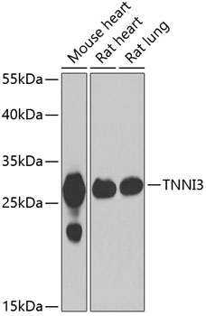 Western blot analysis of extracts of various cell lines using TNNI3 Polyclonal Antibody at dilution of 1:1000.