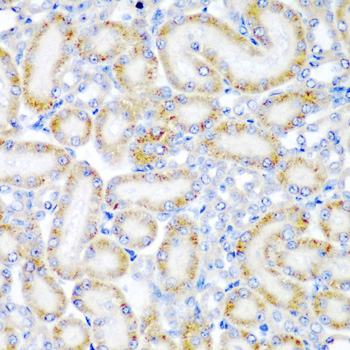 Immunohistochemistry of paraffin-embedded Rat kidney using WRB Polyclonal Antibody at dilution of  1:200 (40x lens).