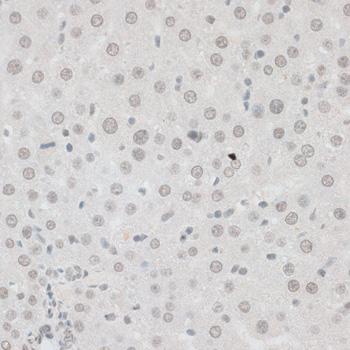 Immunohistochemistry of paraffin-embedded Rat liver using ZNF148 Polyclonal Antibody at dilution of  1:100 (40x lens).