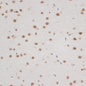 Immunohistochemistry of paraffin-embedded Rat brain using ZNF148 Polyclonal Antibody at dilution of  1:100 (40x lens).