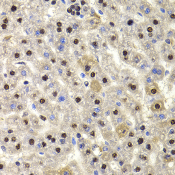 Immunohistochemistry of paraffin-embedded Rat liver using HIRIP3 Polyclonal Antibody at dilution of  1:100 (40x lens).