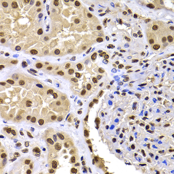 Immunohistochemistry of paraffin-embedded Human kidney using HIRIP3 Polyclonal Antibody at dilution of  1:100 (40x lens).