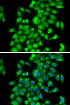 Immunofluorescence analysis of MCF7 cells using COPS3 Polyclonal Antibody