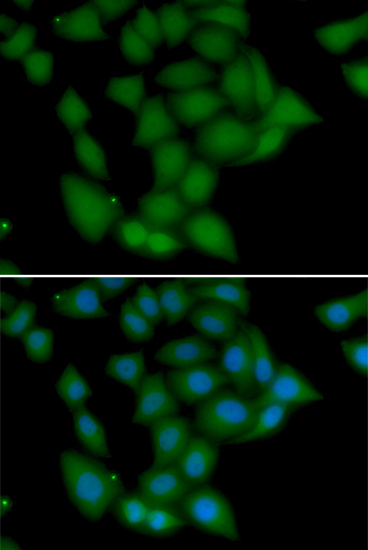 Immunofluorescence analysis of U2OS cells using CAMK1 Polyclonal Antibody