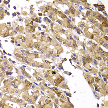 Immunohistochemistry of paraffin-embedded Human gastric damage using ASMTL Polyclonal Antibody at dilution of  1:100 (40x lens).