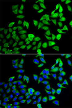 Immunofluorescence analysis of A-549 cells using USP8 Polyclonal Antibody