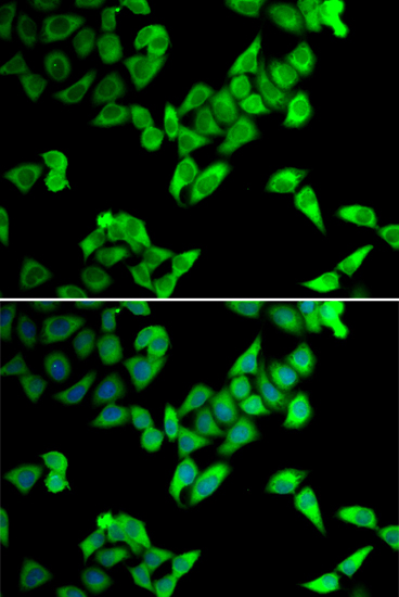 Immunofluorescence analysis of U2OS cells using TRIP10 Polyclonal Antibody