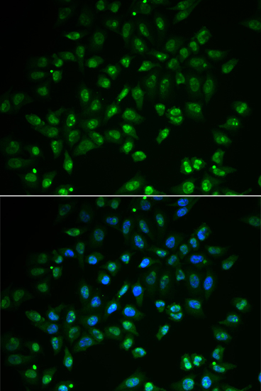 Immunofluorescence analysis of A549 cells using HAND2 Polyclonal Antibody