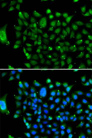 Immunofluorescence analysis of U2OS cells using NCOR1 Polyclonal Antibody