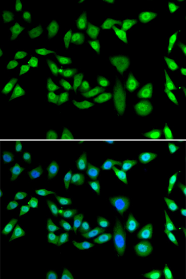 Immunofluorescence analysis of U2OS cells using DNAJB6 Polyclonal Antibody