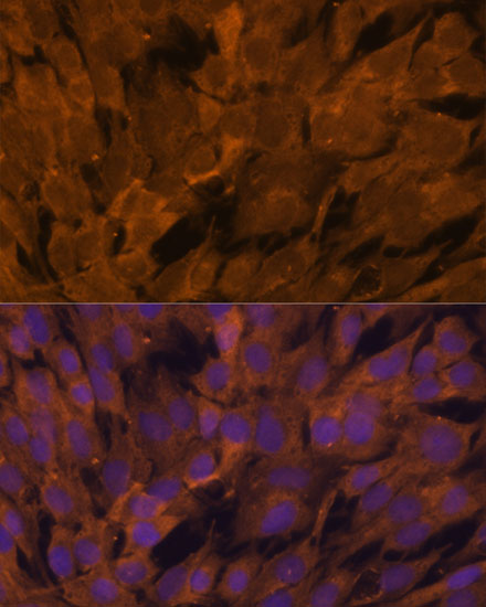 Immunofluorescence analysis of C6 cells using STAM2 Polyclonal Antibody at dilution of  1:100. Blue: DAPI for nuclear staining.