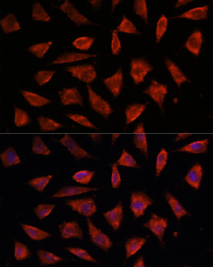 Immunofluorescence analysis of L929 cells using STAM2 Polyclonal Antibody at dilution of  1:100. Blue: DAPI for nuclear staining.