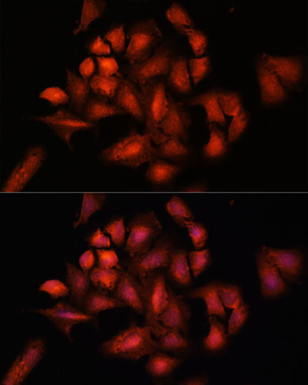 Immunofluorescence analysis of U-2 OS cells using STAM2 Polyclonal Antibody at dilution of  1:100. Blue: DAPI for nuclear staining.