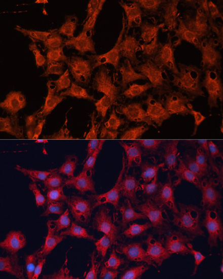 Immunofluorescence analysis of C6 cells using DNAJA2 Polyclonal Antibody at dilution of  1:100. Blue: DAPI for nuclear staining.