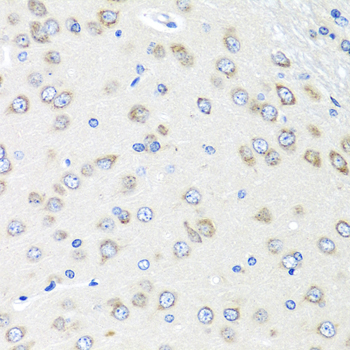 Immunohistochemistry of paraffin-embedded Rat brain using PIAS3 Polyclonal Antibody at dilution of  1:100 (40x lens).