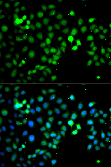 Immunofluorescence analysis of A549 cells using MTF2 Polyclonal Antibody