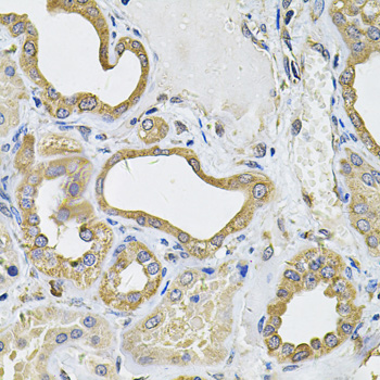 Immunohistochemistry of paraffin-embedded Human kidney using ICOSL Polyclonal Antibody at dilution of  1:100 (40x lens).