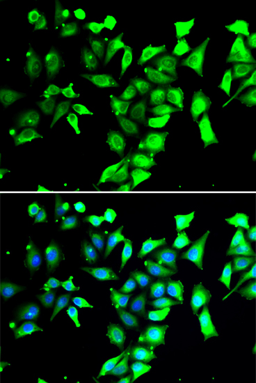 Immunofluorescence analysis of A549 cells using FKBP8 Polyclonal Antibody