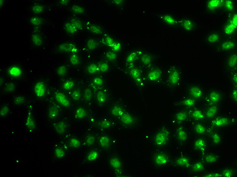 Immunofluorescence analysis of A549 cells using L3MBTL1 Polyclonal Antibody