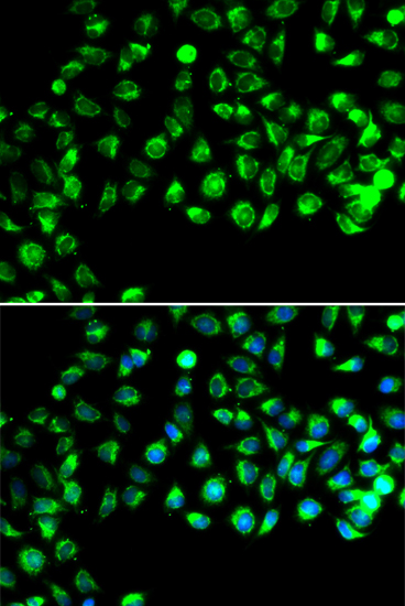 Immunofluorescence analysis of A549 cells using C16orf80 Polyclonal Antibody