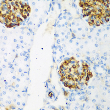 Immunohistochemistry of paraffin-embedded Rat kidney using CSRNP1 Polyclonal Antibody at dilution of  1:200 (40x lens).