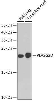 Western blot analysis of extracts of various cell lines using PLA2G2D Polyclonal Antibody at dilution of 1:1000.