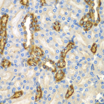 Immunohistochemistry of paraffin-embedded Mouse kidney using CNPY3 Polyclonal Antibody at dilution of  1:100 (40x lens).