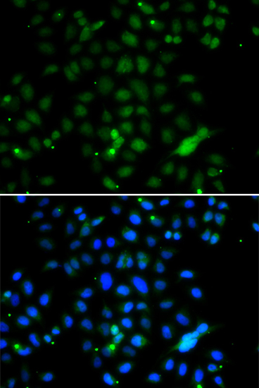 Immunofluorescence analysis of A549 cells using ELF4 Polyclonal Antibody