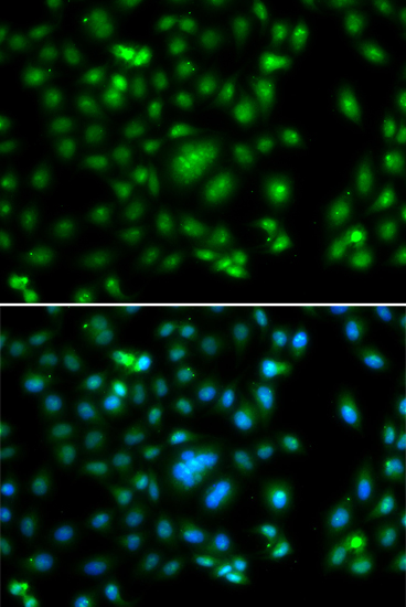 Immunofluorescence analysis of A549 cells using ELF5 Polyclonal Antibody