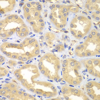 Immunohistochemistry of paraffin-embedded Human kidney using ELMO3 Polyclonal Antibody at dilution of  1:100 (40x lens).