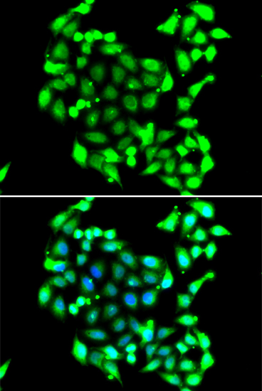 Immunofluorescence analysis of A549 cells using GTF2H3 Polyclonal Antibody