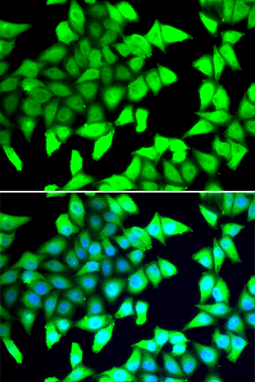 Immunofluorescence analysis of A549 cells using HDAC5 Polyclonal Antibody