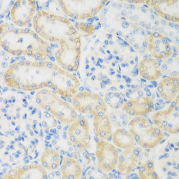 Immunohistochemistry of paraffin-embedded Rat kidney using NAT8B Polyclonal Antibody at dilution of  1:200 (40x lens).