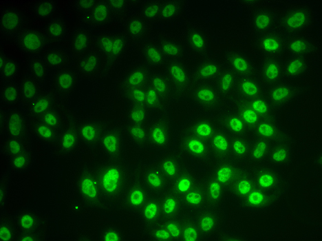 Immunofluorescence analysis of MCF-7 cells using SNRPD1 Polyclonal Antibody