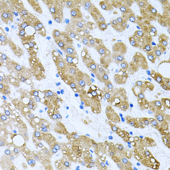 Immunohistochemistry of paraffin-embedded Human liver damage using TOB2 Polyclonal Antibody at dilution of  1:100 (40x lens).