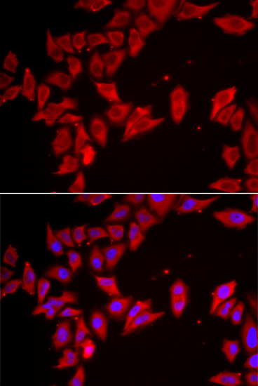 Immunofluorescence analysis of HeLa cells using SLC35A2 Polyclonal Antibody