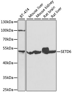 Western blot analysis of extracts of various cell lines using SETD6 Polyclonal Antibody at dilution of 1:1000.