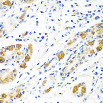 Immunohistochemistry of paraffin-embedded Human stomach using BLVRB Polyclonal Antibody at dilution of  1:100 (40x lens).