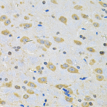 Immunohistochemistry of paraffin-embedded Rat brain using BNIP1 Polyclonal Antibody at dilution of  1:100 (40x lens).