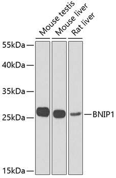 Western blot analysis of extracts of various cell lines using BNIP1 Polyclonal Antibody at dilution of 1:1000.