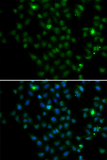 Immunofluorescence analysis of MCF-7 cells using LMO4 Polyclonal Antibody