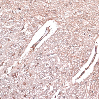 Immunohistochemistry of paraffin-embedded Rat brain using LMO4 Polyclonal Antibody at dilution of  1:100 (40x lens).