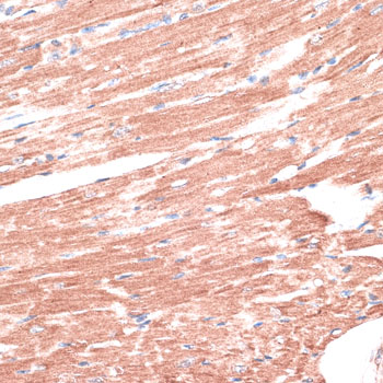 Immunohistochemistry of paraffin-embedded Mouse heart using LMO4 Polyclonal Antibody at dilution of  1:100 (40x lens).