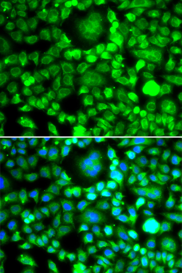 Immunofluorescence analysis of MCF-7 cells using BLID Polyclonal Antibody