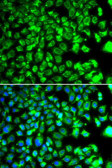 Immunofluorescence analysis of MCF-7 cells using C10orf32 Polyclonal Antibody