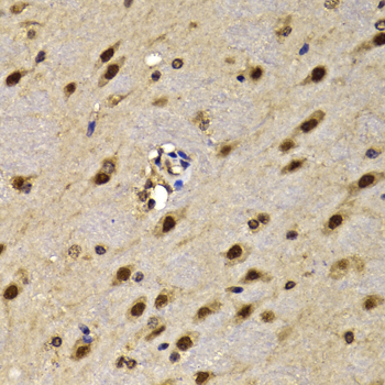 Immunohistochemistry of paraffin-embedded Mouse brain using HMG20A Polyclonal Antibody at dilution of  1:100 (40x lens).