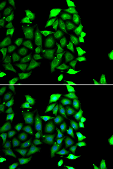 Immunofluorescence analysis of MCF-7 cells using IKZF3 Polyclonal Antibody