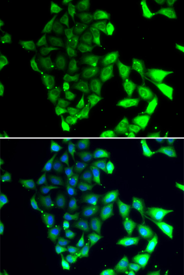 Immunofluorescence analysis of MCF-7 cells using MID1 Polyclonal Antibody