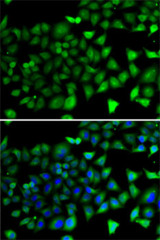 Immunofluorescence analysis of A-549 cells using NFYB Polyclonal Antibody